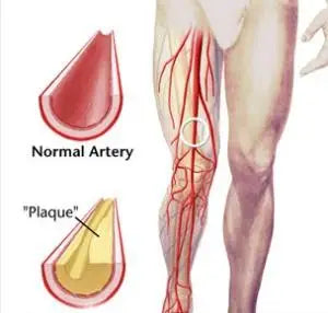 Medical Compression Socks Medical Thigh Socks Prevent Varicose Veins Slim Sock Men Women Outdoor Running Long Pressure Stockings