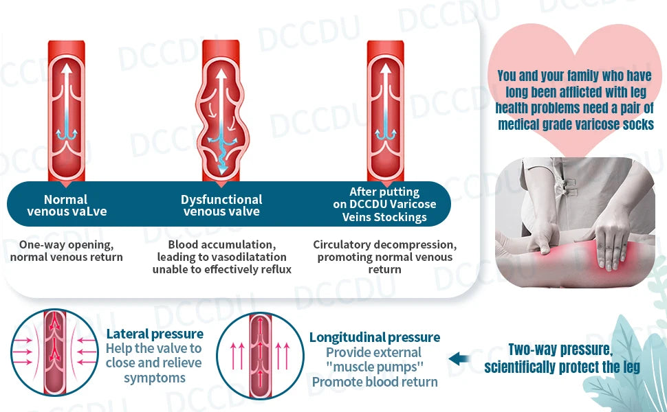 Medical Compression Socks Medical Thigh Socks Prevent Varicose Veins Slim Sock Men Women Outdoor Running Long Pressure Stockings